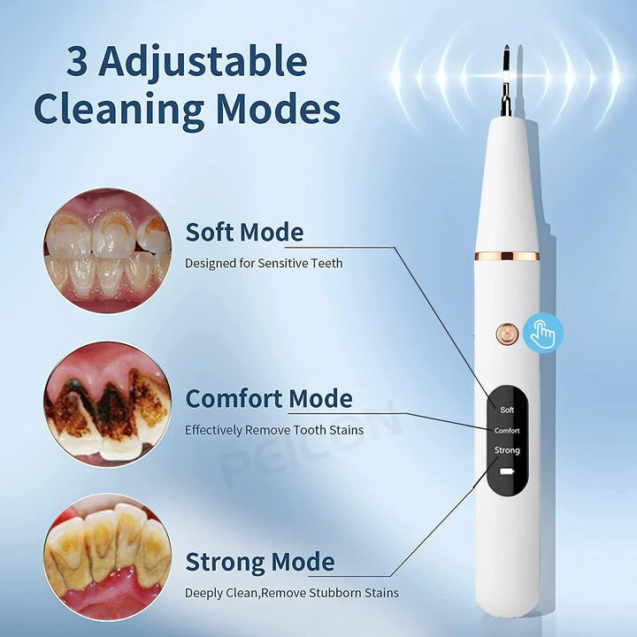 Ultrasone Tandenreiniger - SonicClean