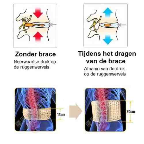 Decompressie Brace - Strek je Rug, Verlicht je Dag