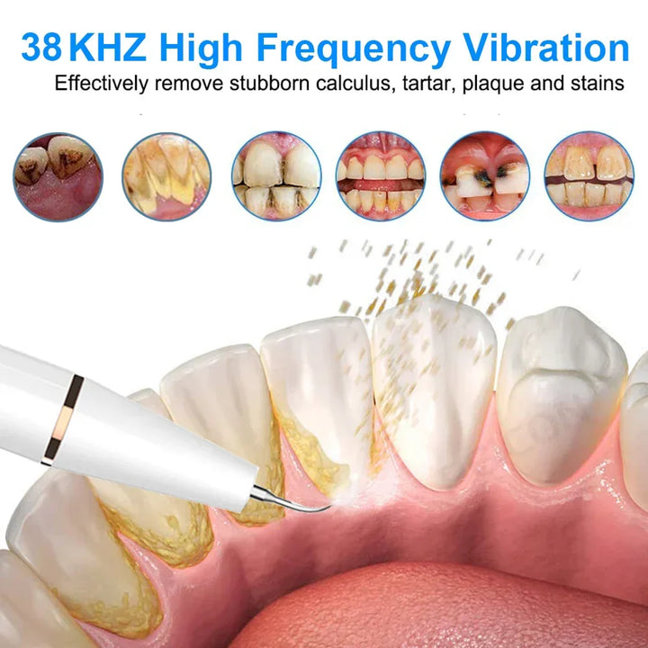 Ultrasone Tandenreiniger - SonicClean