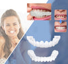 Opsteek-veneers | Flexibele, lijmvrije pasvorm voor maaltijden en dagelijks gebruik