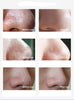 Face Formula - Mee-eter verwijderende neusstrips